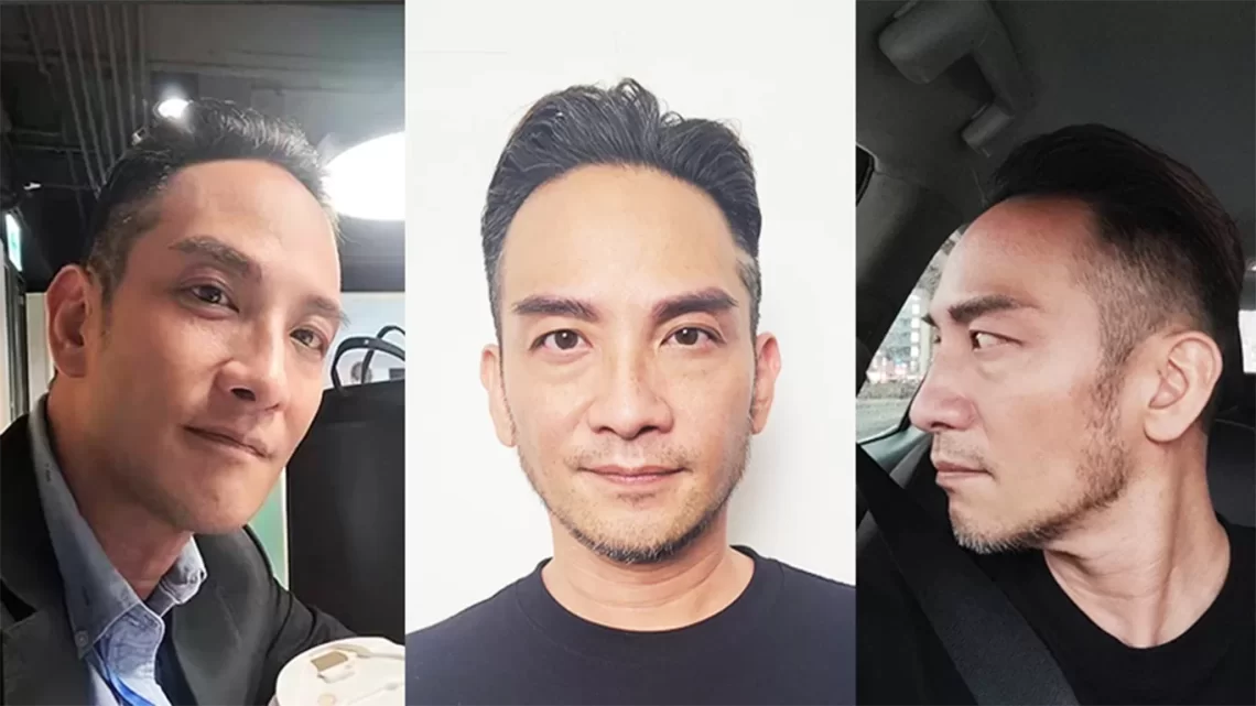 高山峰變man了！原來是找醫師「植眉」