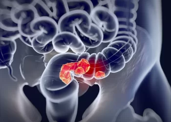 糞檢陽性速作大腸鏡-超過這時間，罹癌風險增3成！