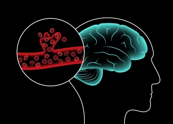 腦中風診斷-ai來助攻！-90秒迅速診斷-安全風險低準確率高？