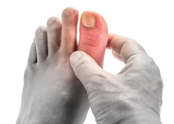 不要再誤會豆類製品了？這3類食物才是痛風殺手！