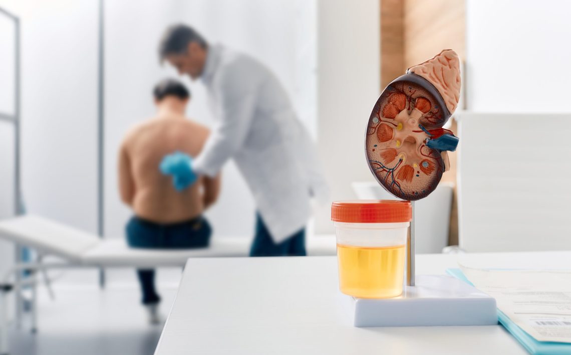 6旬翁腎臟「淹水」追根究底竟是罹癌