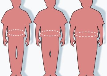 全台兒童每3人就1人過胖？醫警告7成長大後繼續胖