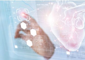 網購內衣琳瑯滿目選擇多-sioher熹歐禾建議從口碑款入門