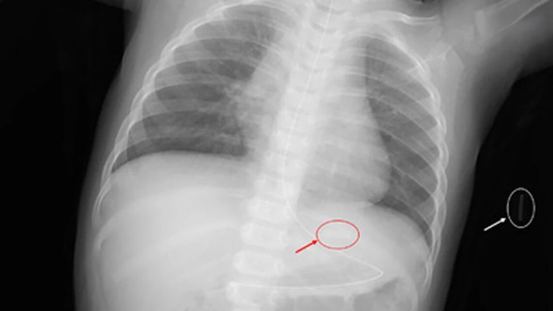 危機暗藏-國際加熱菸傷童案例頻傳-台灣審查機制亟待完善