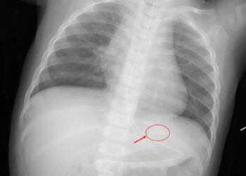 危機暗藏-國際加熱菸傷童案例頻傳-台灣審查機制亟待完善