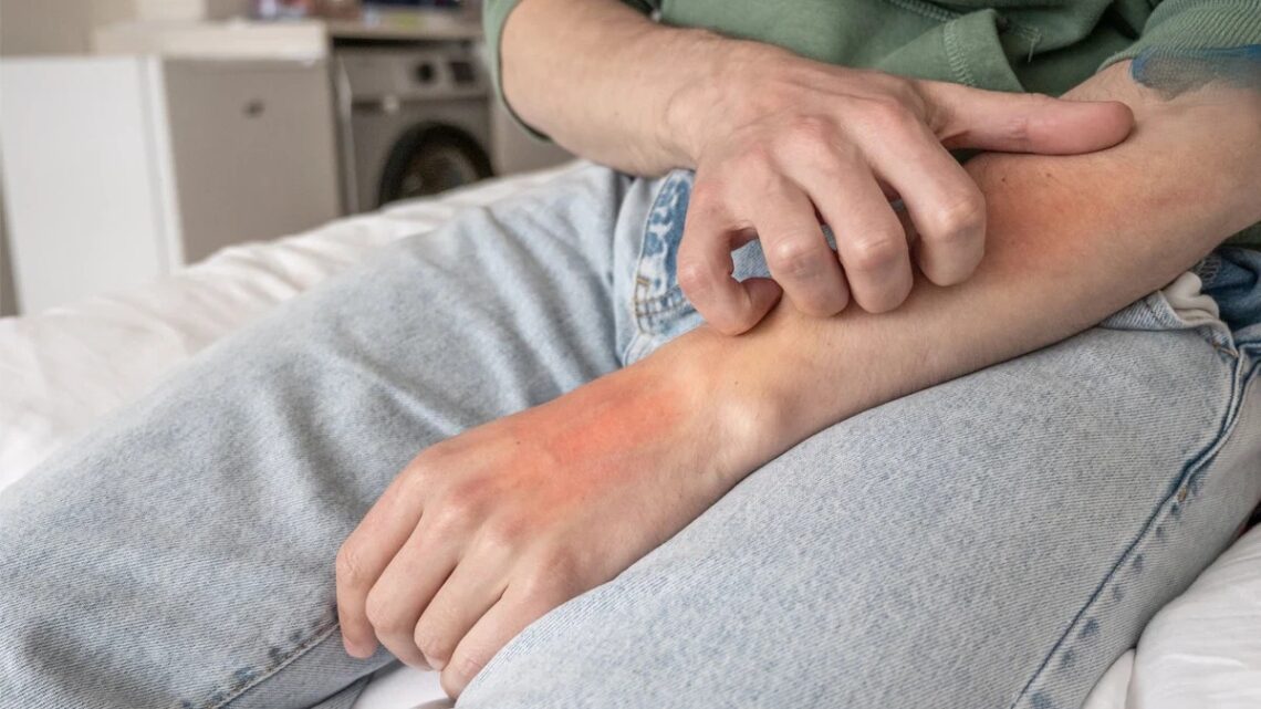 中醫調理乾癬-內外兼治-溫和改善皮膚困擾-擺脫紅疹瘙癢-重拾健康自信