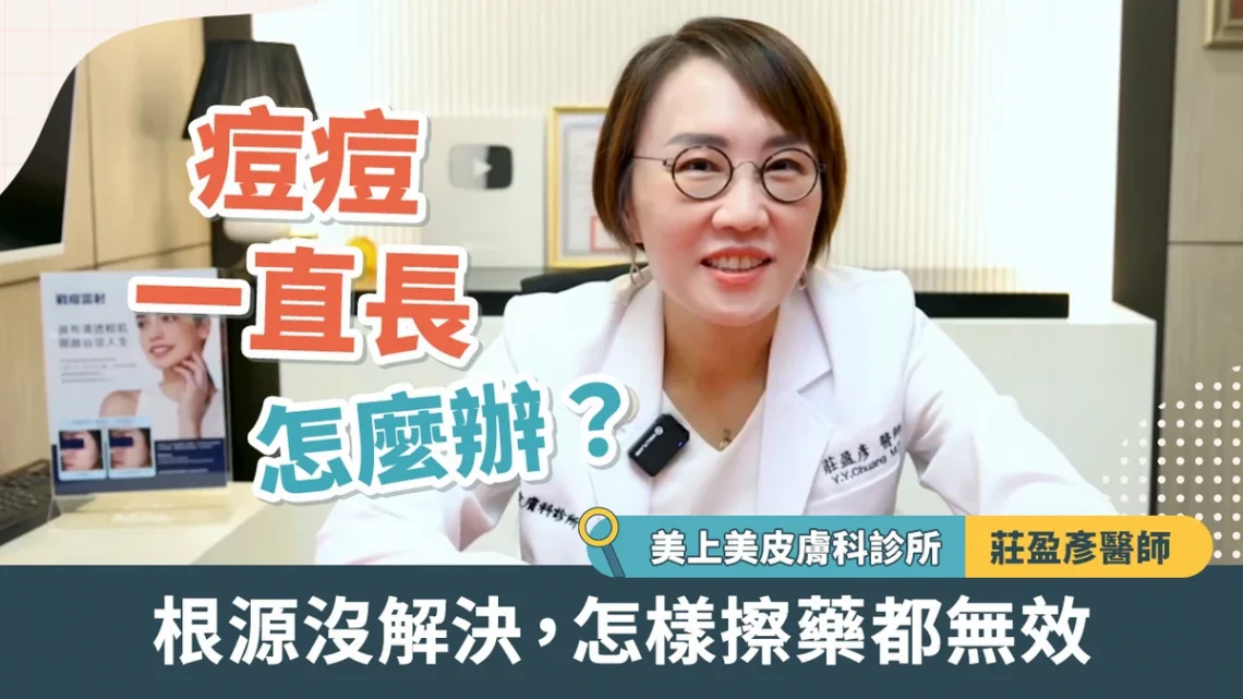 痘痘一直長怎麼辦?莊盈彥醫師:根源沒解決 怎樣擦藥都無效
