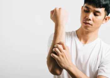 卸下長袖 告別脫皮人生 醫：穩控乾癬避免引發關節炎