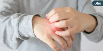 20歲男大生乾癬疾病延燒關節誤認痛風 醫籲提早控制發炎為關鍵