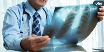 50歲男肺癌連葉克膜都用上！免疫治療+抗血管新生合併化療穩病情