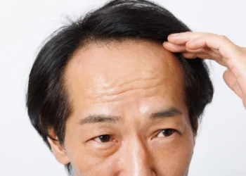 落髮不一定只和荷爾蒙有關 醫毛囊微環境失衡也可能讓髮量變少